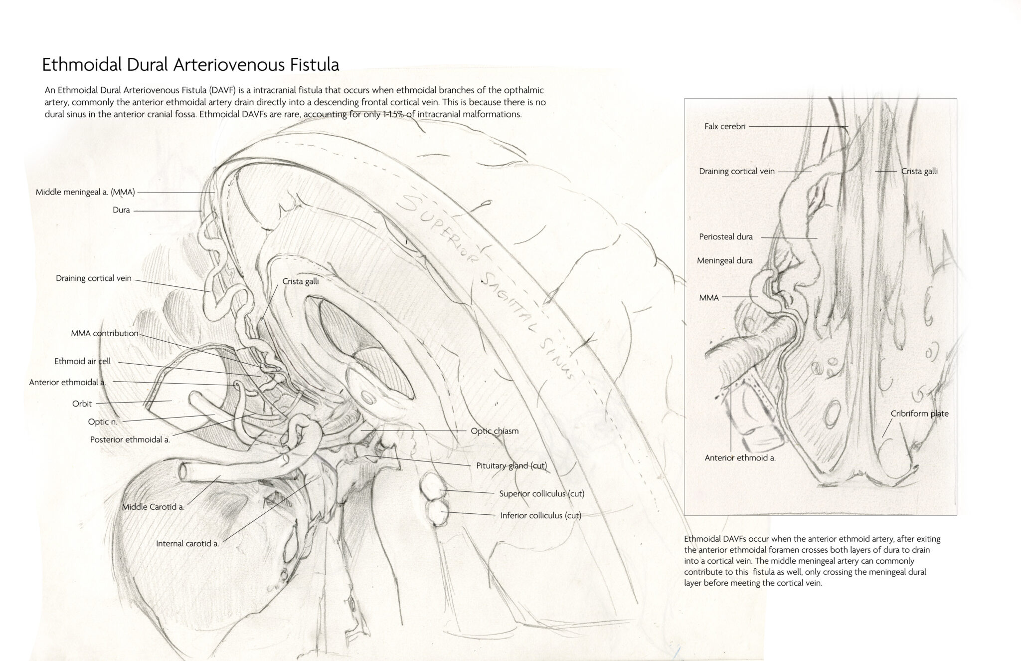 neurofinalsketch